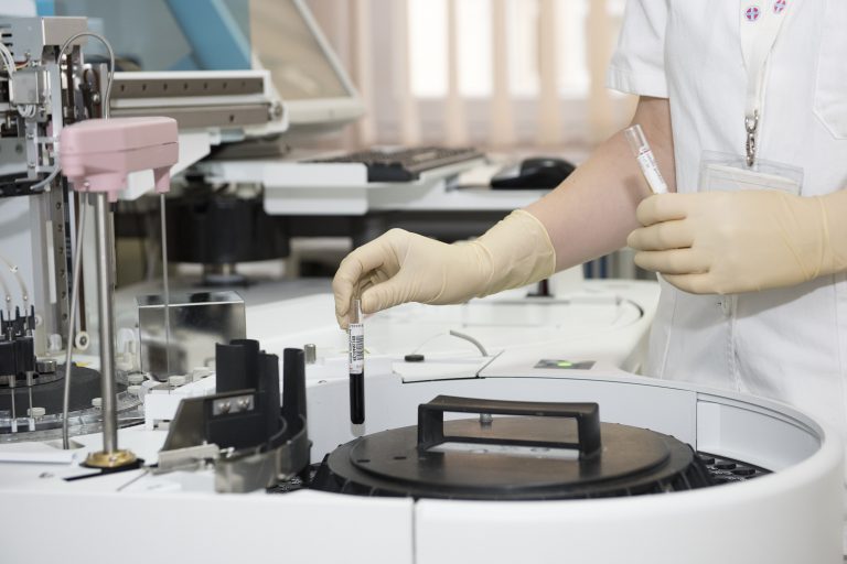 What Does HbA1c Measure?