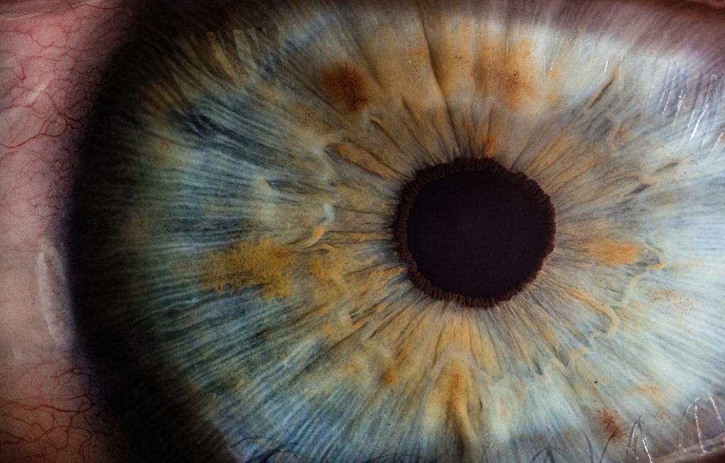 Vision of a retina without diabetic damage
