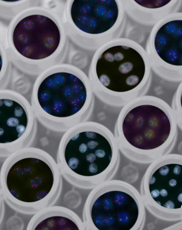 Personalized Medicine is the future of healthcare