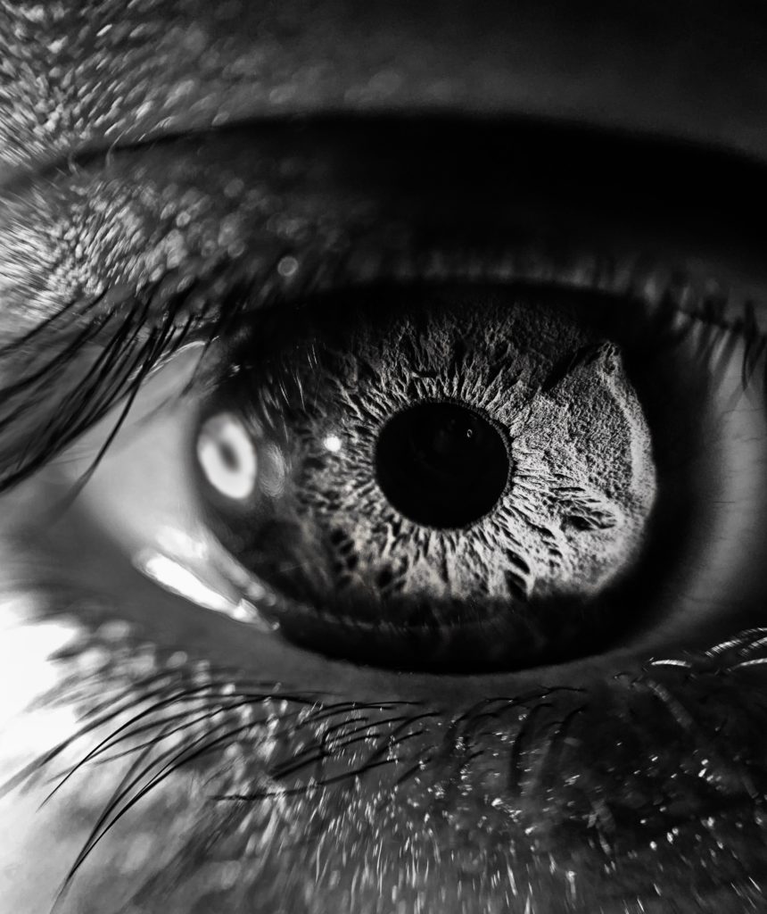 Catarcts and other eye diseases can stem from stress