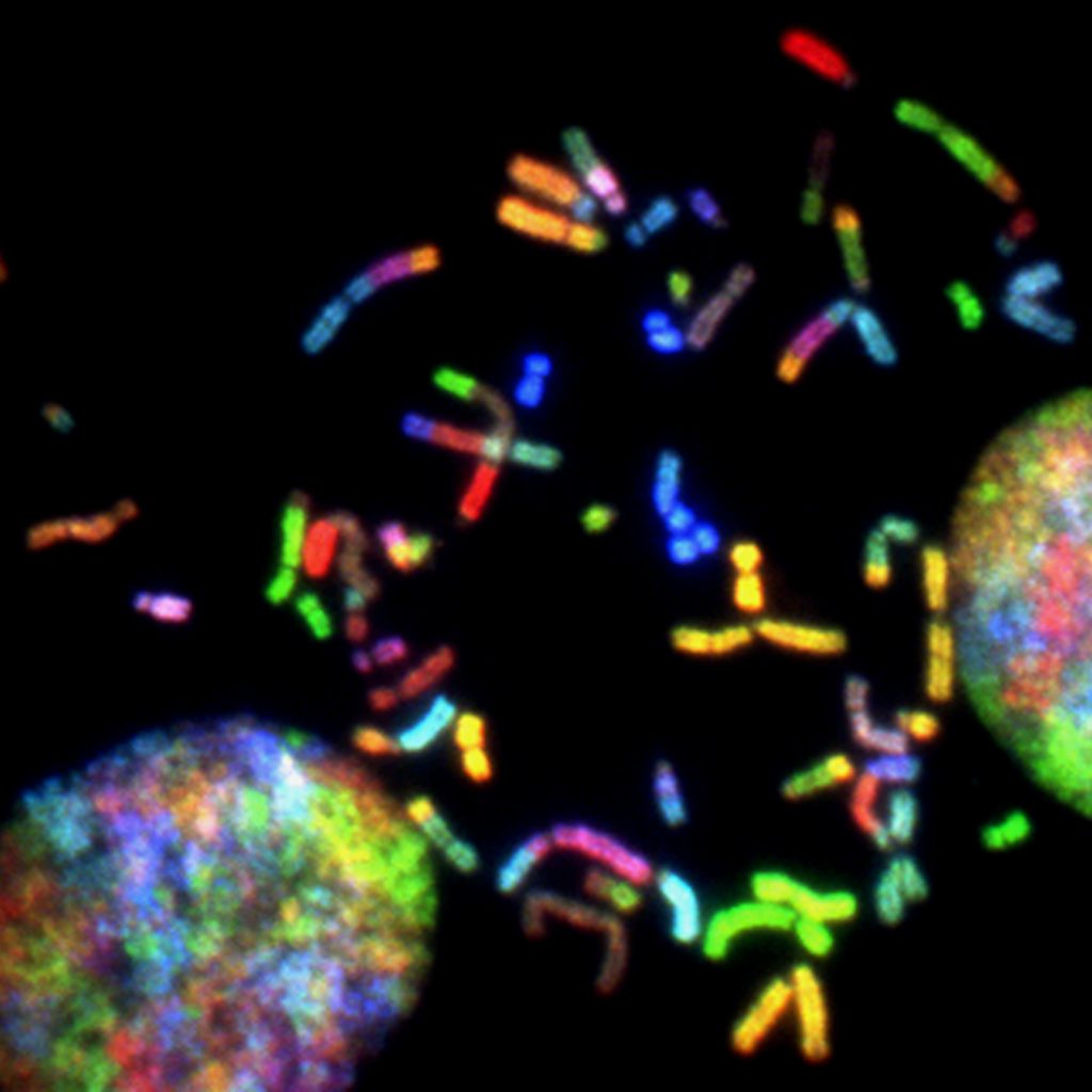 Our DNA and genetics determine our likelihood of developing diabetes